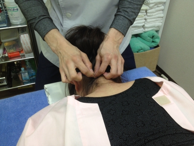首、肩、腕、腰どこに行っても改善しなかった方！はり治療はじめませんか？