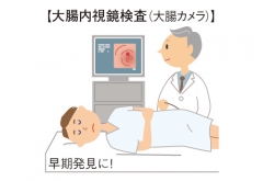 大腸内視鏡検査
